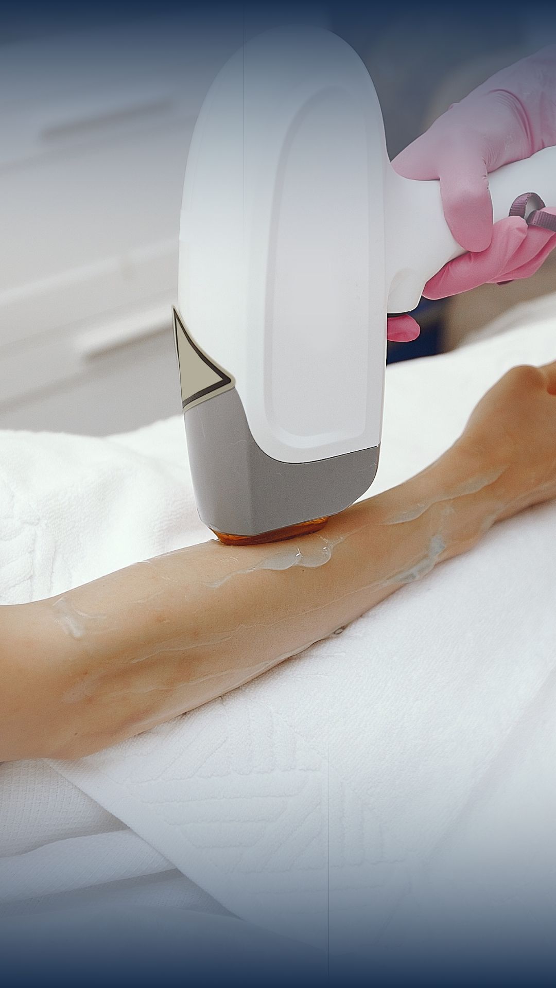 laser-hair-removal-lower-stondon