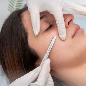 dermaplaning-course-lower-stondon